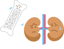 治療開始の基準